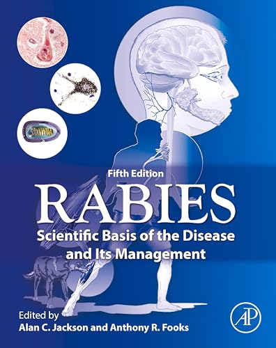 Rabies: Scientific Basis of the Disease and Its Management
