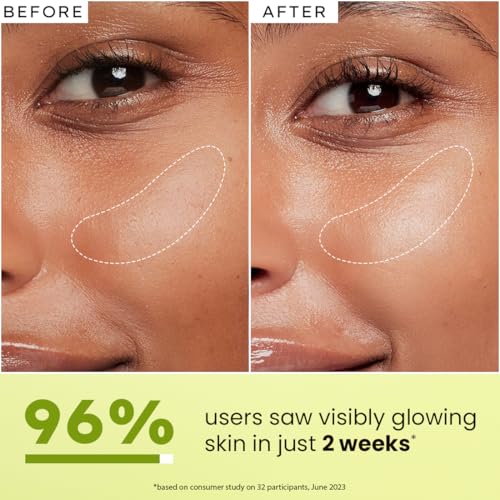 Image of Hyphen 5% Niacinamide, 1% Alpha Arbutin & 25% Kakadu Plum Brightening Face Serum | 20X Vitamin C for Glowing Summer Skin | Hydrating Serum for Dark Spots, Pigmentation & Dryness | All Skin Types
