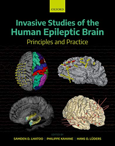 Invasive Studies of the Human Epileptic Brain: Principles and Practice Invasive Studies of the Human Epileptic Brain: Principles and Practice