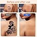 20 PCS Invisible Tattoo Cover-Up Patch, Waterproof & Breathable Concealer for Tattoos, Scars, Birthmarks – Darker Skin Tone