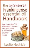 skin therapy oil palmers face review  The Uncensored Frankincense Essential Oil Handbook: How to Use the \"Oil of Miracles\" for skin care, pain relief & a buttload of other issues. (Uncensored Essential Oil Handbooks) (English Edition)