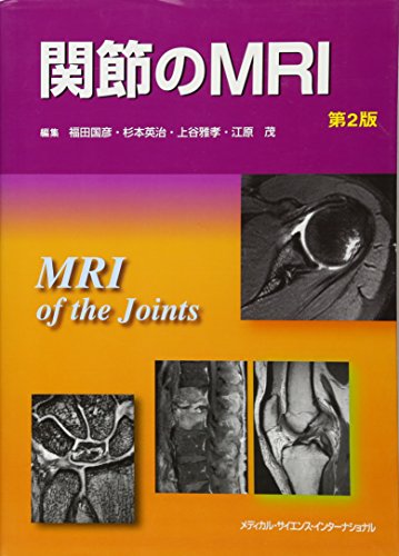 無料電子書籍 おすすめ 関節のMRI 第2版 バイ