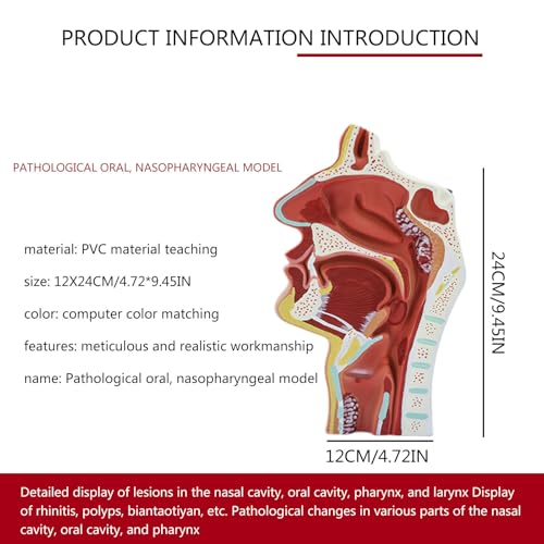 Modèle de pathologie ENT de taille réelle AMITD avec polypes et amygdalite - 6