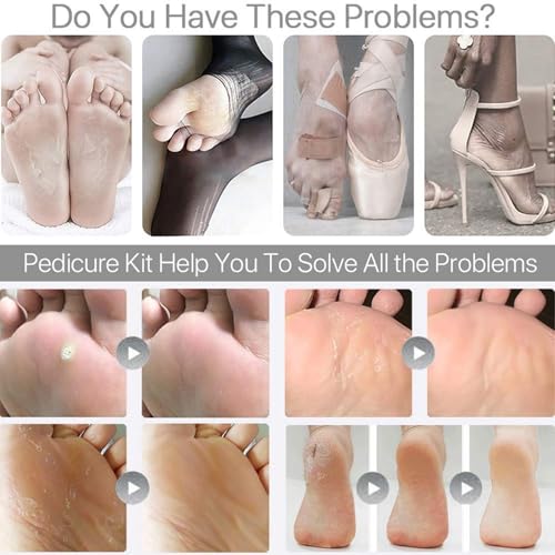 Image of Keli 8 Pcs Pedicure Tools Set for Men and Women - Professional Callus Remover Kit for Foot Care with Foot File, Dead Skin Remover, Heel Scraper & Nail Cleaner for Smooth Soft Feet at Home & Salon