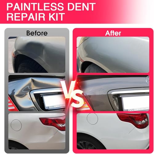 Image of Paintless Dent Removal Hot Glue Gun Kit, 100W PDR Glue Gun for Dent Repair, 1-2Min Fast Heating Glue Gun with 15 Glue Sticks, Professional Auto Body Dent Puller Tool