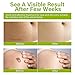 Keloid Bump Removal, Scar Treatment Cream, Silicone Acne Scar Gel, Gentle Effective Aftercare Solution for Injury & Surgery, Skin Repair for Face & Body, 20g