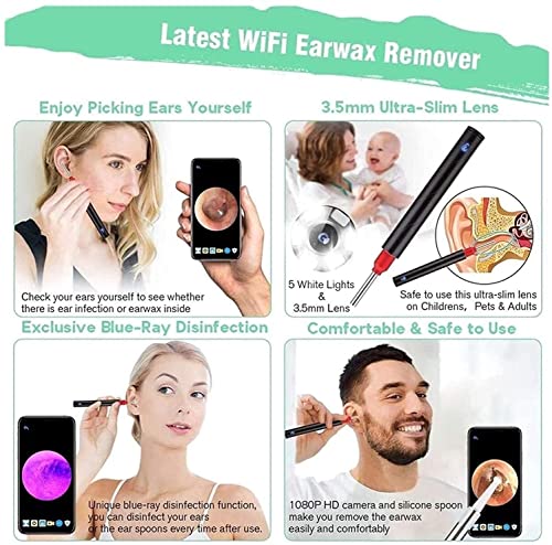 Mxjcc Ear Wax Removal Tool Camera, Ear Cleaning Kit Smart Visual Ear Cleaner, Ear Scope With Ear Wax Cleaner Tool For Babies Kids Adults Pets #TOP4