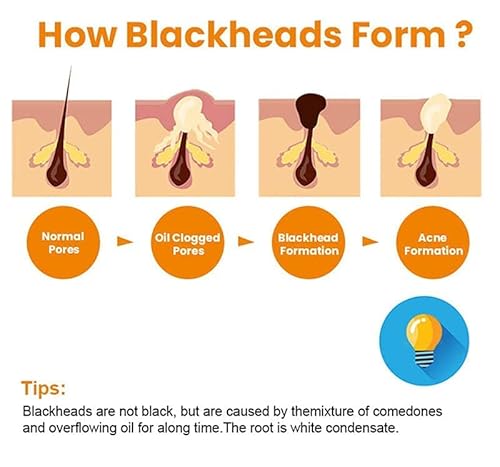 Fionel Carrothue Carrot Bubble Clarifying Mask,Deep Cleansing Moisturizing Carrot Mask(3Box) #TOP2