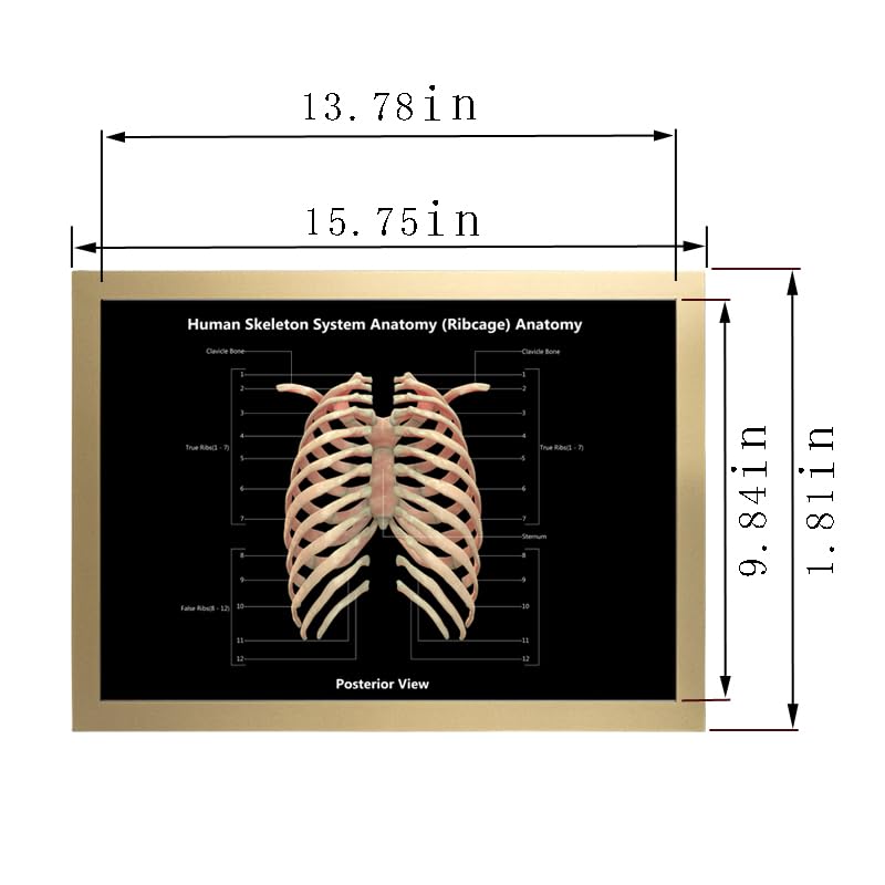 Image of Taanfu Body Educational Learning Anatomy Posters ，Skeleton System Art Intestinal Skeleton Anatomy Art Poster Digestive System Organs Illustration Small Intestine Physiology Anatomy Wall Art Villi