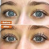 Missicee B07WK68KVJ lato 2