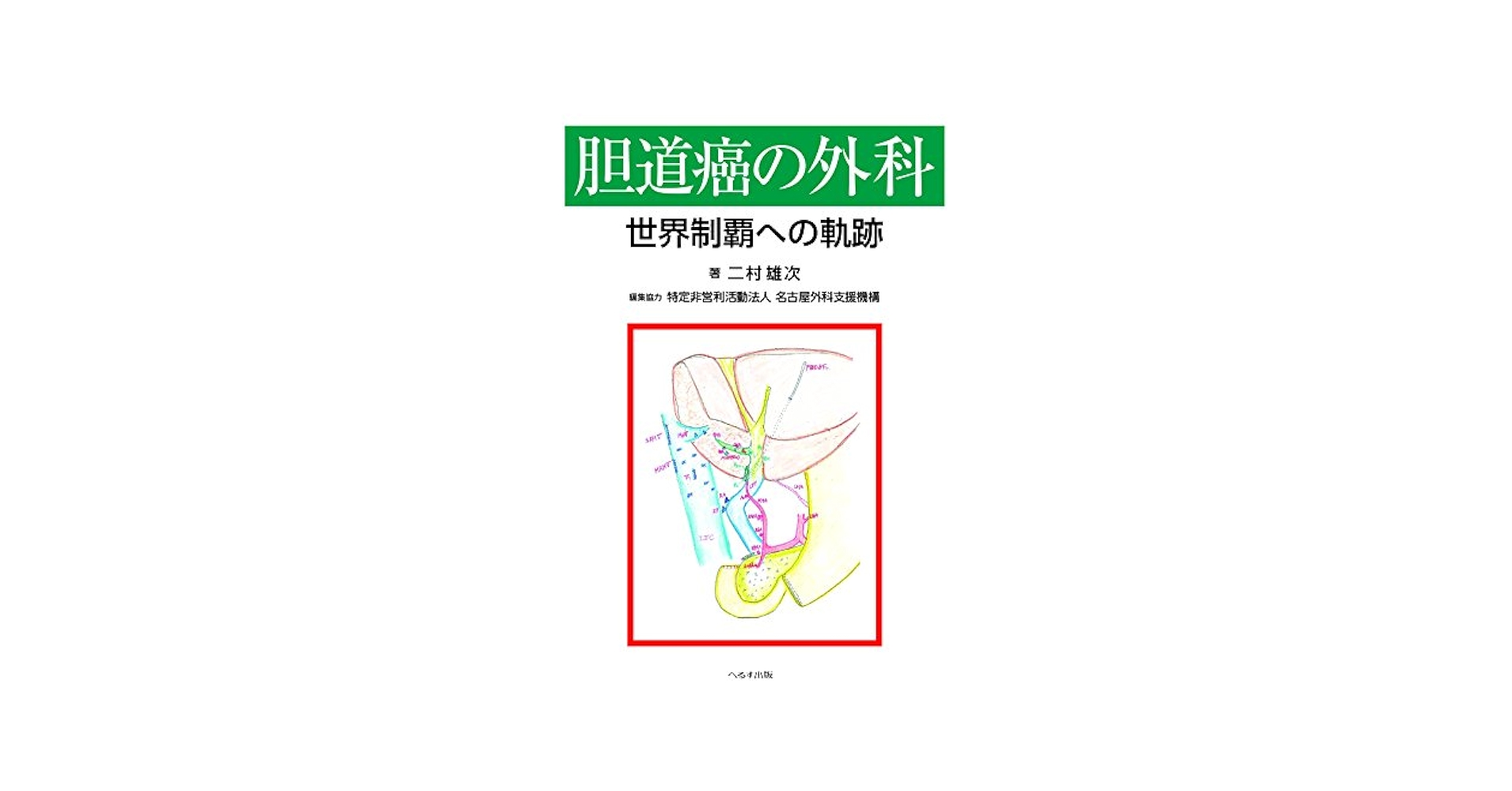 胆道癌の外科 世界制覇への軌跡/へるす出版/二村雄次（大型本） Amazon.co.jp: 胆道癌の外科: 世界制覇への軌跡 : 二村雄次