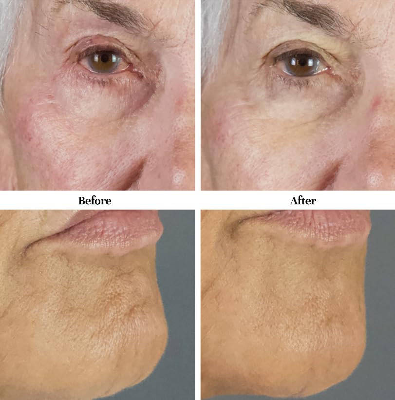 City Beauty MicroBiome Night Mask - Nourishing Overnight Face Mask - Prebiotic & Probiotic Blend - Solution for Dull, Uneven Skin Tone, Large Pores, & Wrinkles - Anti-Aging Cruelty-Free Skin Care - Image 2