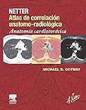 gotway tesla review  Netter. Atlas de correlación anatomo-radiológica: Anatomía cardiotorácica