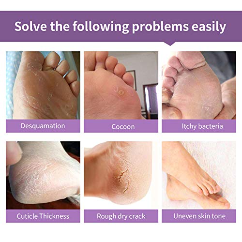 image for WOAYUS Foot Peel Mask, 2 Pack Exfoliating Foot Peeling Spa Masks for D