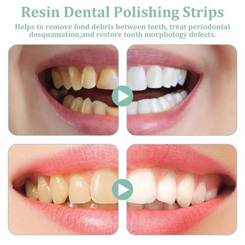 75Pcs Zahn Schleifpapier 3 Rauheit Zahnschleifpapier für Zwischenräume Zahn Polierstreifen Polierstreifen Zähne Tragbare Zahn Schleifpapier für Zahnsteinentfernung Polieren von Zähnen