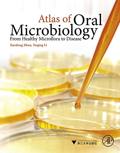 Atlas of Oral Microbiology: From Healthy Microflora to Disease