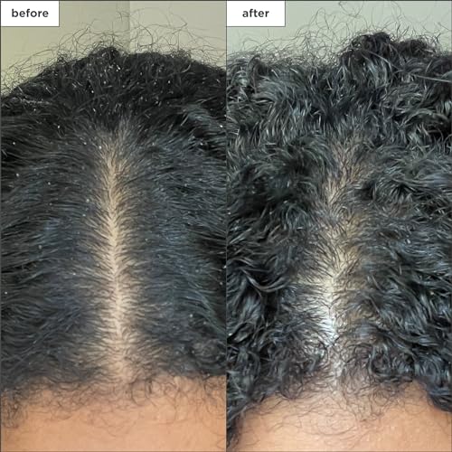 image for Briogeo Scalp Revival Charcoal + Coconut Oil Micro-Exfoliating Shampoo