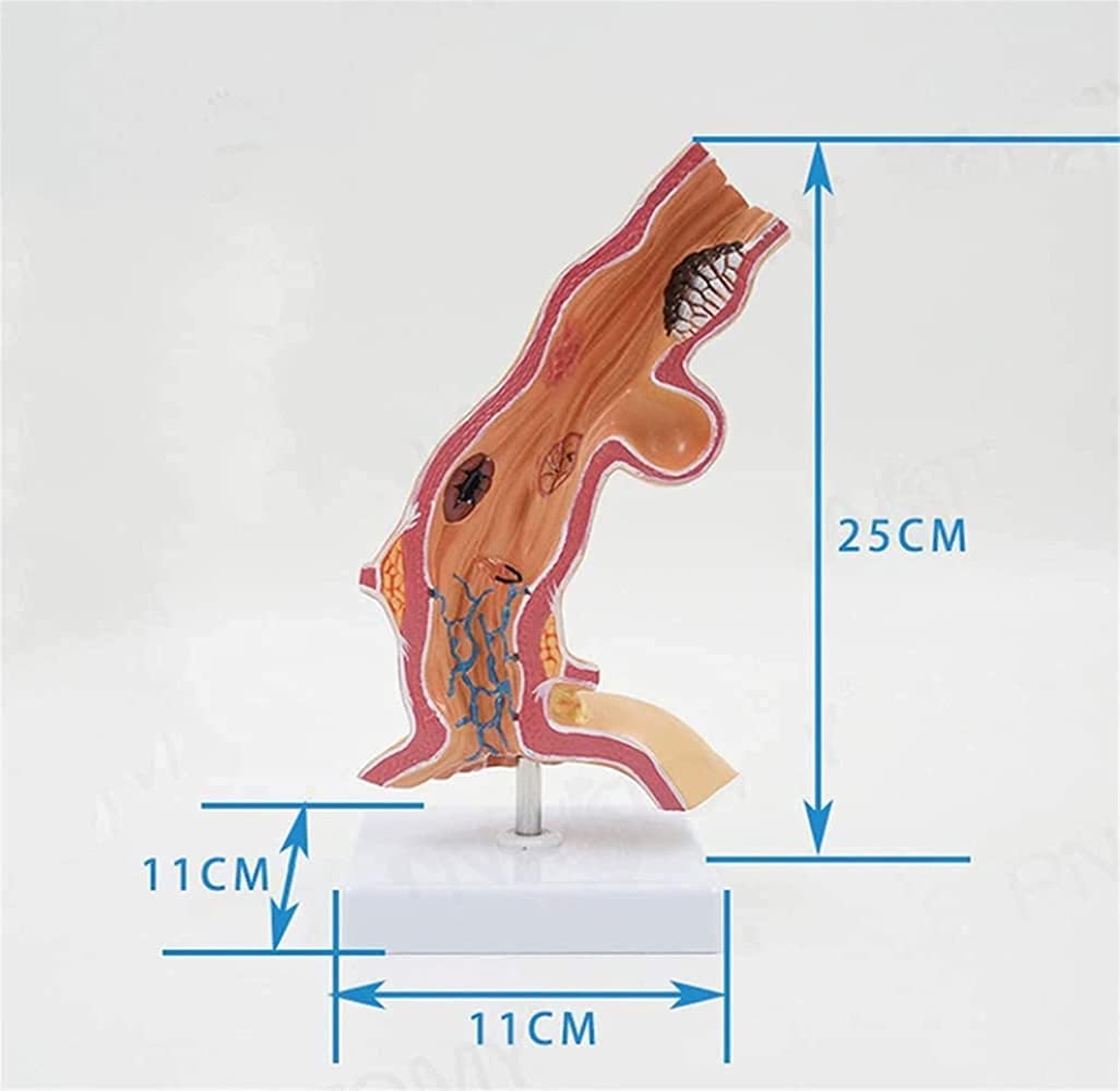 Modelo anatómico del esófago Humano, Departamento de anatomía médica del esófago y Modelo de digestivo para Obtener Ayuda con la capacitación médica, Equipos de Laboratorio.
