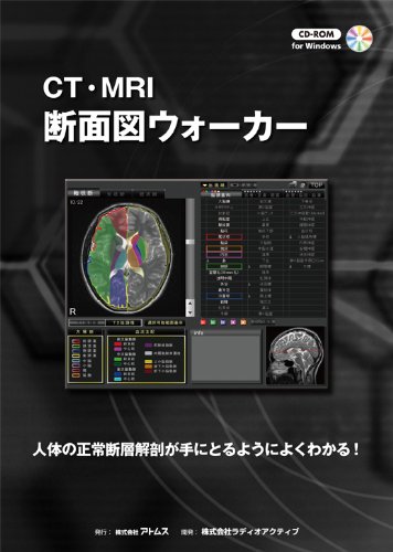 無料電子書籍 pdf CT・MRI 断面図ウォーカー バイ