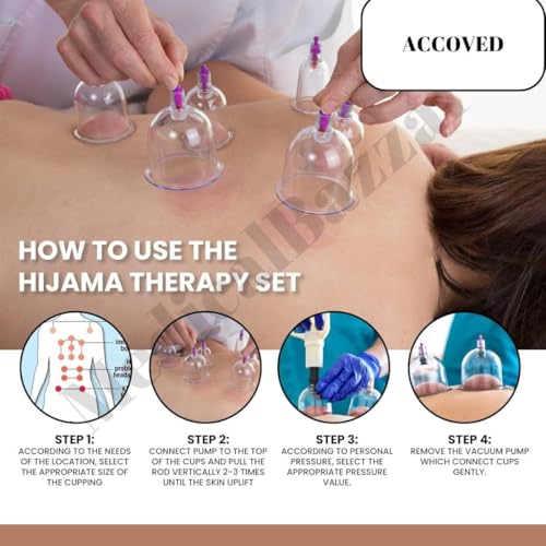 Image of Medical Bazaar Cupping Therapy Cups | Hijama Cupping Set (Size 0-6) | Loose Cups for Professional Cupping Therapy|Pain Relief |Massage| Detox Therapy (S5-3.5CM(set of 10pcs))