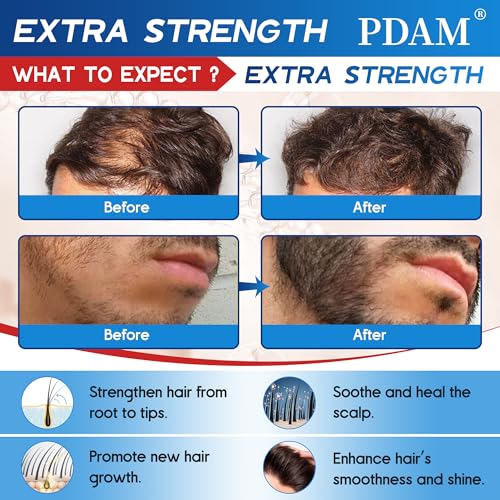 Image of Minoxidil for Men Hair Growth Spray - 5% Topical Minoxidil for Hair and Beard Growth, Extra Strength Hair Regrowth Treatment for Hair Loss & Thinning Hair, 2 Fl Oz (60ml) *2