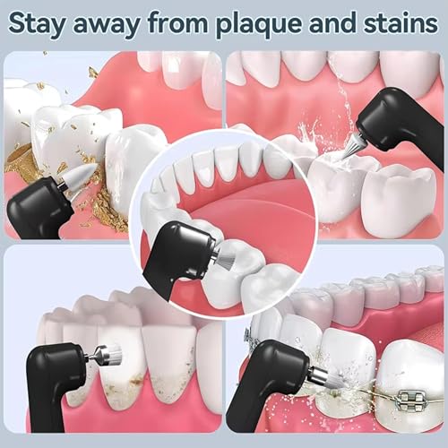 Image of MEDITIVE Tooth Polisher,Teeth Polishing Kit for Daily Cleaning Polishing USB Rechargeable Dental Polisher