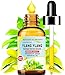 Botanical Beauty YLANG YLANG Essential Oil 100% Pure Natural Undiluted Therapeutic Grade Essential Oil 2 Fl.oz.- 60 ml for Aromatherapy, Soaps, Candles, Diffusers & Reed Diffusers