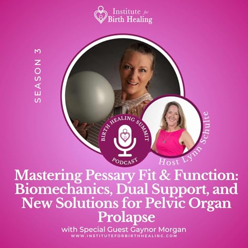 Page de couverture de Mastering Pessary Fit & Function: Biomechanics, Dual Support, and New Solutions for Pelvic Organ Prolapse