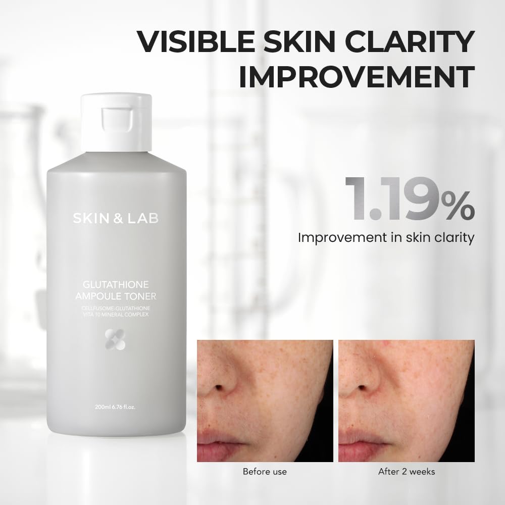 skin lab glutathione Amazon.com: [Skin&LAB] Glutathione Ampoule Toner 6.76 fl oz, Improve Dart  Spot, Hyperpigmented, Skin Clarity, Korean Toner for Sensitive Skin :  Beauty & Personal Care