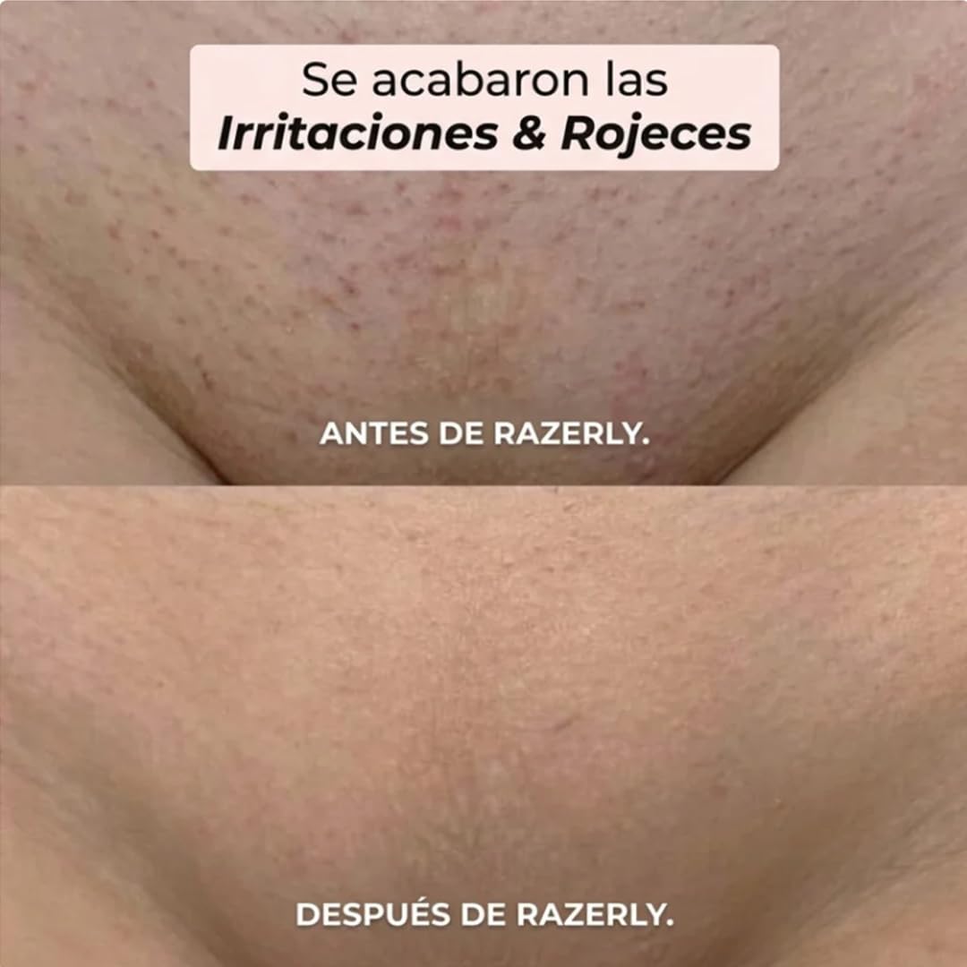 Razerly Maquinilla Mujer, Afeitadora Eléctrica Impermeable IPX7, Recargable USB-C, Sin Irritaciones Para Todo El Cuerpo (Blanco)