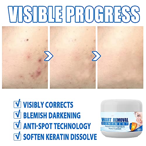 Instant Blemish Removal Gel Skin Tags, Fast Wart