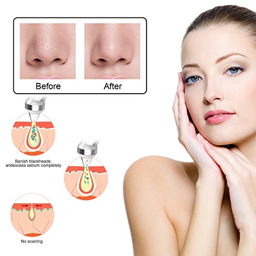 Aspiratore Punti Neri,THZY Viso Pore Naso