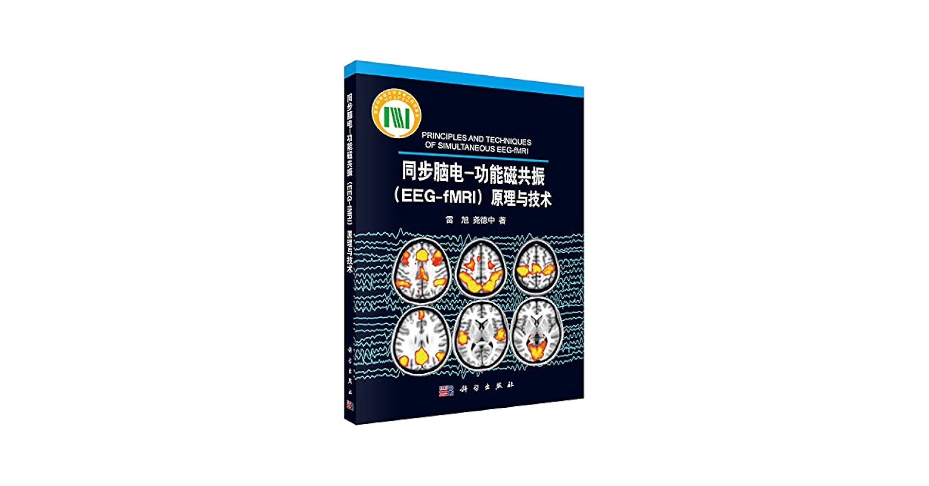 Amazon.com: Synchronous EEG: functional magnetic resonance