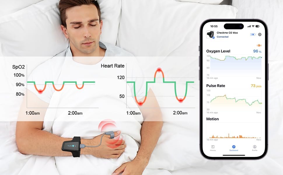 User wearing Wellue O2 Pulse Oximeter during daytime activity