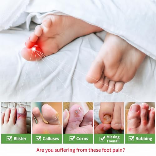 Image of Niupiour Gel Toe Protectors, 14 Packs of Breathable Toe Covers, Big Toe Caps Guards for Men and Women, Toe Sleeves for Ingrown Toenails, Corns, Blister, Calluses, Toe Cushions for Foot Pain Relief