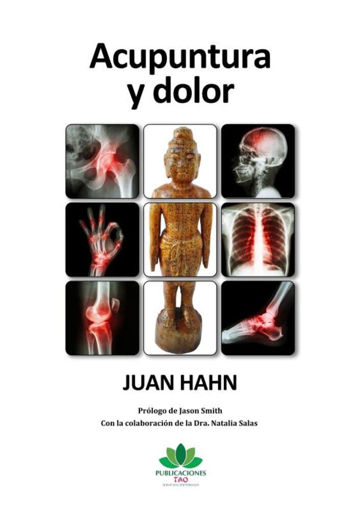 Acupuntura y dolor (Spanish Edition)