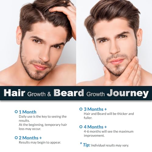 5% Minoxidil Hair Growth Spray, Minoxidil for Women Hair Growth, Minoxidil for Men Beard Growth, Hair Regrowth for Men, Minoxidil 5 Percent Hair Loss Treatments for Women and Men.