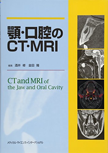 無料電子書籍 pdf 顎・口腔のCT・MRI バイ
