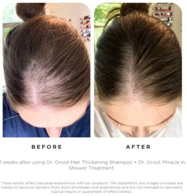 Dr Groot Scalp Revitalizing Solution Hair Thickening Shampoo, For All Scalp Types, Dermatologically Tested, Volumizing & Strengthening Formula, 700 ml (23.66 fl oz) Compare to Dr.ForHair & Revitalift