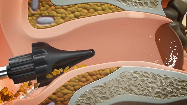 Ear Wax Removal, Electric Ear Irrigation Flushing System - Water Powered Ear Cleaners with DIY Pressure, Safe & Effective Earwax Removal Kit - Waterproof USB Rechargeable - Gift for Him Father :