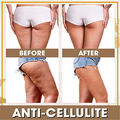 4dslim Vetverbrandende Crème, 3 Stuks Hete Crème, Burnup Ultieme Cellulitis Verwarmingsspray, Gewichtsverlies Snelle… - Afbeelding 8