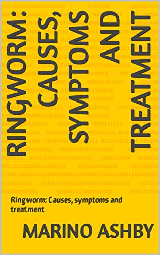 Ringworm: Causes, symptoms and treatment: Ringworm: Causes, symptoms and treatment
