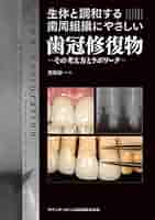 生体と調和した咬合のために 生体と調和する歯周組織にやさしい歯冠修復物 | 遊亀 裕一 |本