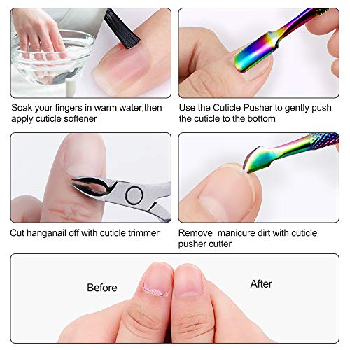 OurTop Nagelhautzange, 5 Stück Nagelhautentferner Nagelhaut Nipper Trimmer Cuticle Nipper Set Nagelhautentferner und… – Bild 5