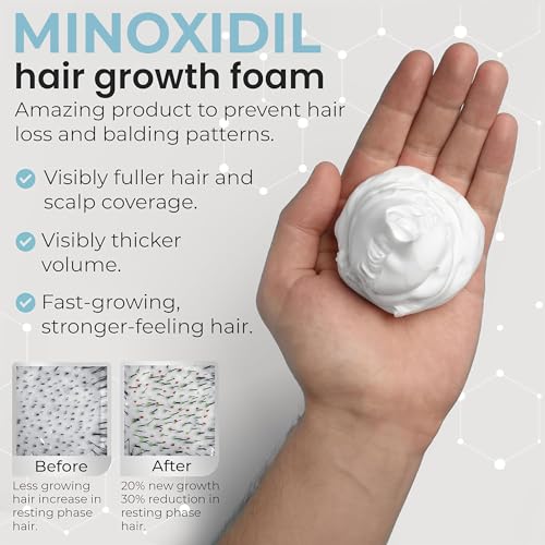 Image of Remixidil Men's 5% Minoxidil Foam Hair Regrowth Treatment for Men, 3 Month