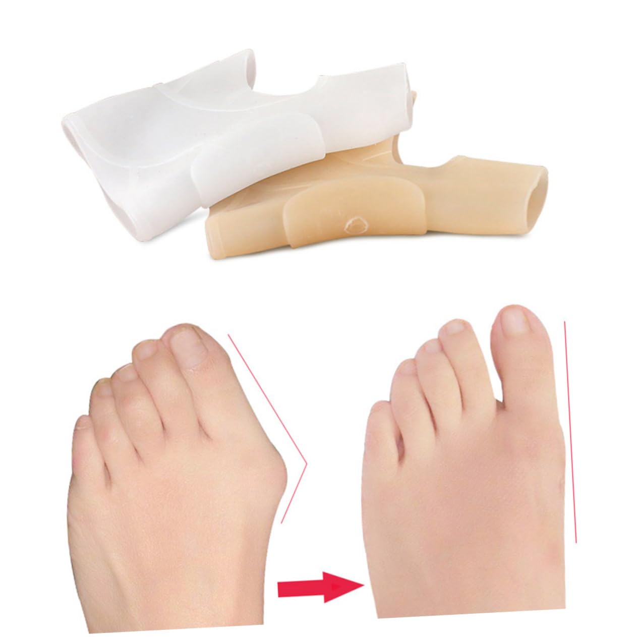 Beavorty 4 Pairs Set Small Separator Bunion Hallux Straightener White/skin Breathable Foot Care Orthotic