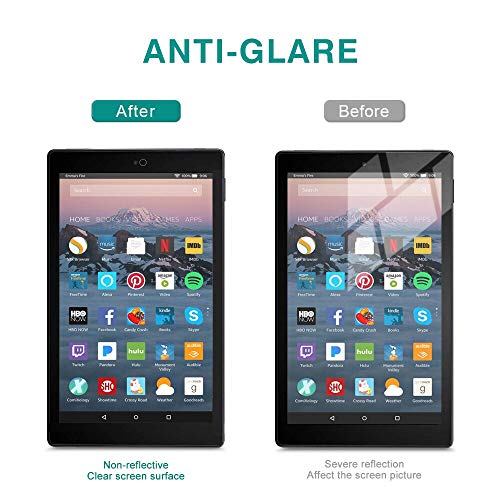 Zoegaa FIRE 10 Anti-Blue Light Screen Protector For Amazon Fire Hd 10 Tablet 10.1 Inch thumb #5
