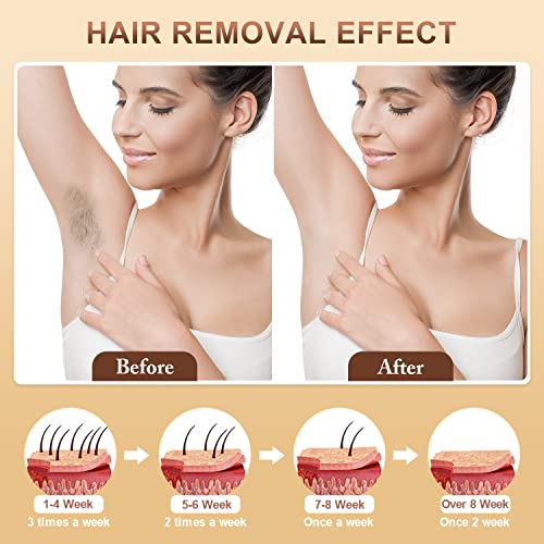 Aopvui AI01 Laser Hair Removal Device thumb #7