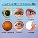 Ultra Eye Therapy Drops – Tlopa Ultra Eye Drops für intensivste Pflege und Eye Care bei Dry Eyes. Best Moisture Eye Drops für eine klare,10Pcs/1Box (10PCS) Feuchtigkeits -Augenpflegelösung