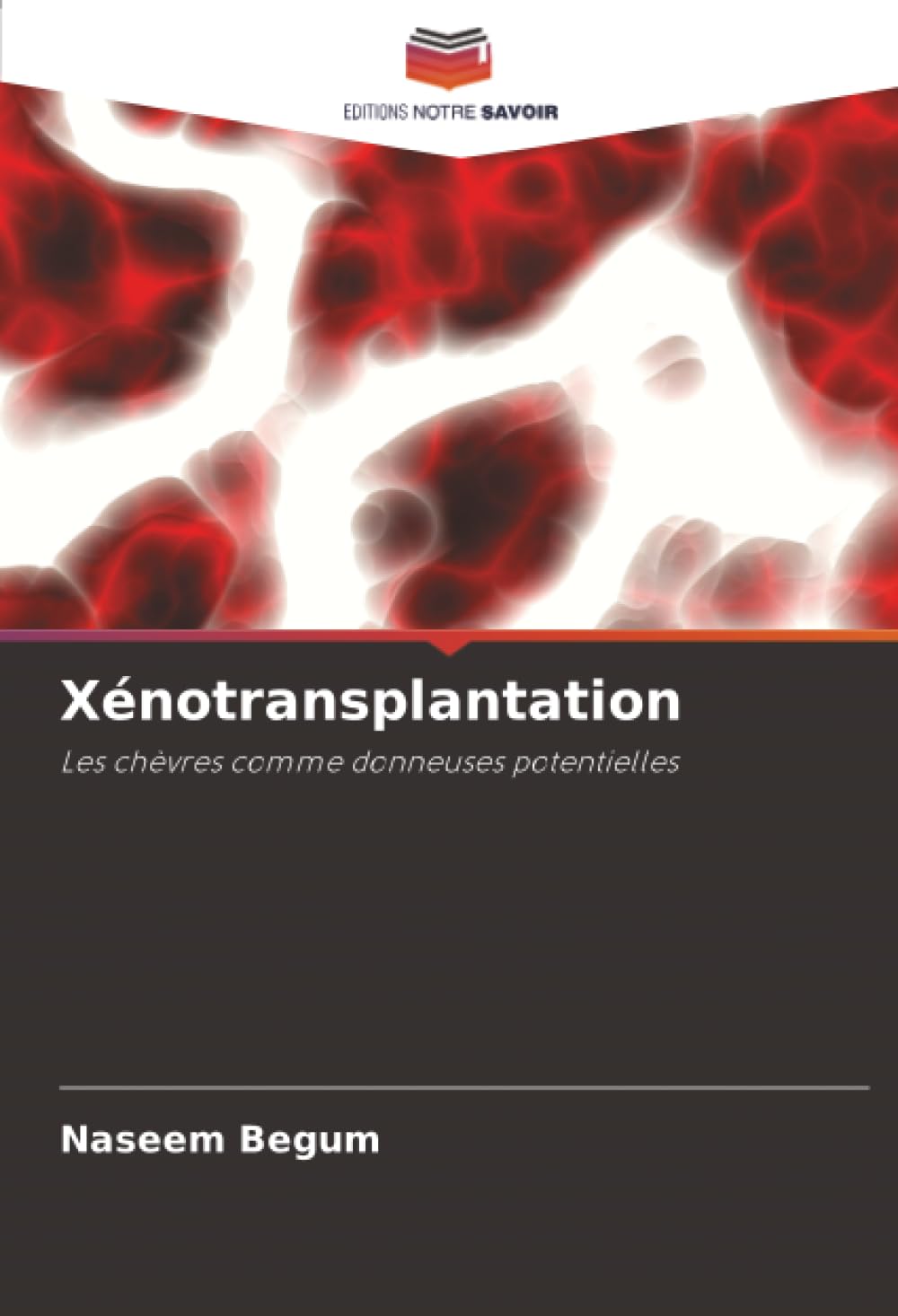 Xénotransplantation: Les chèvres comme donneuses potentielles